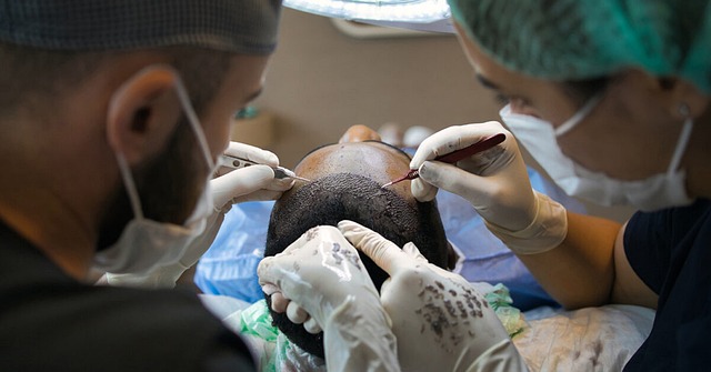 Hårtransplantation i Tyrkiet: Spar penge og få professionel behandling